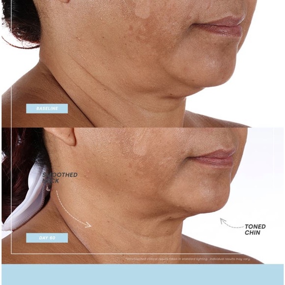 Nuface Mini+ Petite Facial Toning Device Microcurrent Skincare in Sandy Rose - Picture 8 of 10